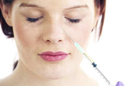 Nechirurgická rinoplastika s výplněmi