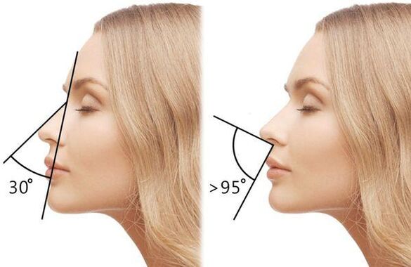 měření úhlu nosu